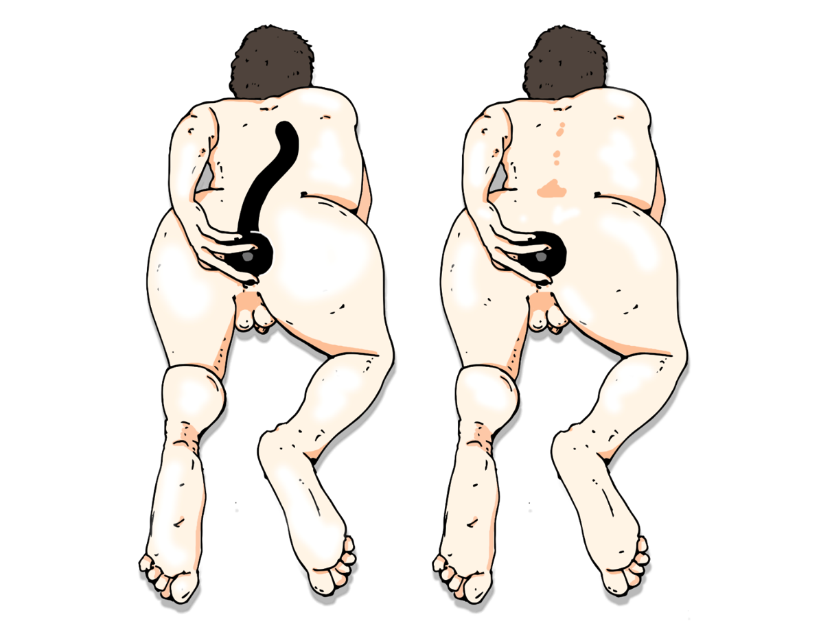 Наконец, рекомендую обзавестись так называемым тренером глубины (дип-тренер) – это должна быть совсем не толстая, но очень длинная и гибкая игрушка, введение которой в кишечник на глубину 30 см и более поможет подразнить дальний сфинктер (переход в сигмовидную кишку) и проверить, что за ним не притаилось сюрпризов.